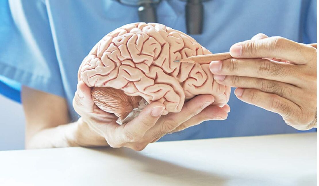 Best Neurologist in Mumbai